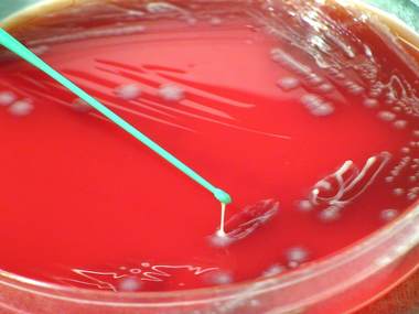 Blood agar strep