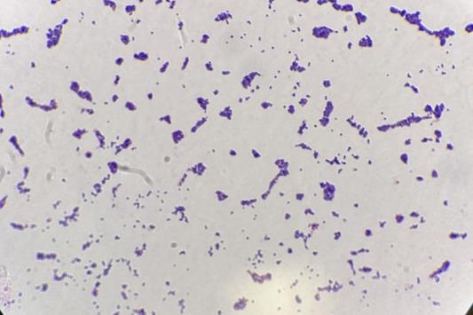 7134_staphgramstain1_190874_crop.jpg